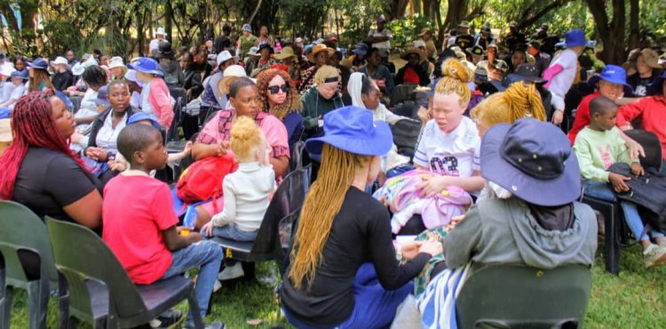 Albinism advocates push for inclusion and empowerment to tackle poverty and discrimination